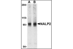 Western blot analysis of NALP2 in PC-3 cell lysate with this product at (A) 1 and (B) 2 μg/ml.