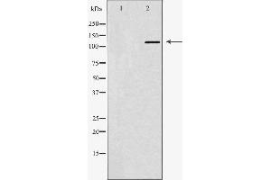 Western blot analysis of Hela whole cell lysates, using ABL1 Antibody. (ABL1 Antikörper  (N-Term))