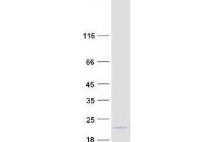 Validation with Western Blot (MAX Protein (Transcript Variant 5) (Myc-DYKDDDDK Tag))