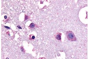 Anti-CRF1 antibody  ABIN1048460 IHC staining of human human brain, neurons and glia. (CRHR1 Antikörper  (N-Term))