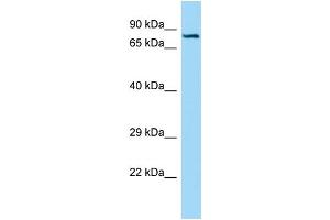 WB Suggested Anti-SEMA7A Antibody Titration: 1. (SEMA7A Antikörper  (C-Term))