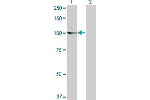 Western Blot analysis of KIT expression in transfected 293T cell line by KIT monoclonal antibody (M02), clone 6F2. (KIT Antikörper  (AA 41-140))