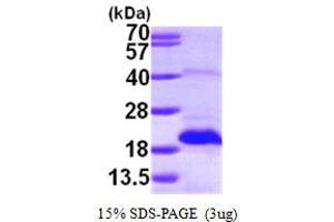 SDS-PAGE (SDS) image for Methionine Sulfoxide Reductase B2 (MSRB2) (AA 21-182) protein (His tag) (ABIN667287) (MSRB2 Protein (AA 21-182) (His tag))