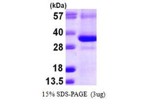 SDS-PAGE (SDS) image for CTD (Carboxy-terminal Domain, RNA Polymerase II, Polypeptide A) Small Phosphatase 1 (CTDSP1) (AA 1-260) protein (His tag) (ABIN667902)