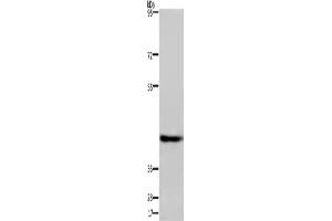 Western Blotting (WB) image for anti-Developmentally Regulated GTP Binding Protein 1 (DRG1) antibody (ABIN2429959) (DRG1 Antikörper)