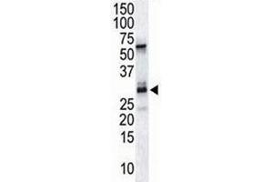 The DSCR1 antibody used in western blot to detect DSCR1 in endothelial tissue lysate (RCAN1 Antikörper  (AA 222-252))