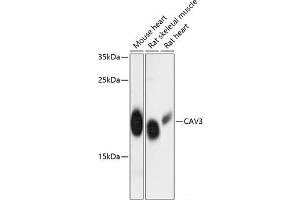 Western blot analysis of extracts of various cell lines using CAV3 Polyclonal Antibody at dilution of 1:3000. (Caveolin 3 Antikörper)