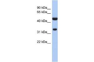 SULT1B1 antibody used at 1 ug/ml to detect target protein. (SULT1B1 Antikörper  (N-Term))