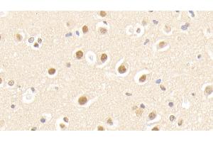 Detection of APPBP1 in Human Cerebrum Tissue using Polyclonal Antibody to Amyloid Beta Precursor Protein Binding Protein 1 (APPBP1) (Amyloid beta Precursor Protein Binding Protein 1 (AA 229-534) Antikörper)