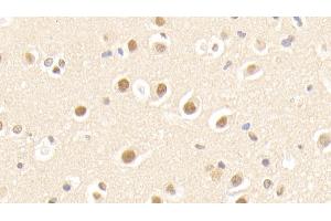 Detection of APPBP1 in Human Cerebrum Tissue using Polyclonal Antibody to Amyloid Beta Precursor Protein Binding Protein 1 (APPBP1) (NAE1 Antikörper  (AA 229-534))