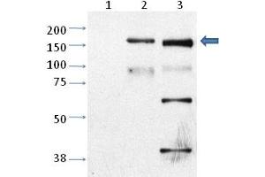 Western blot analysis of Trpm2 in CHO cells untransfected (Lane 1), CHO cell transfected with rat TRPM2 (Lane 2) and mouse cortical neurons (cultured) (Lane 3) with Trpm2 polyclonal antibody . (TRPM2 Antikörper  (AA 1430-1508))