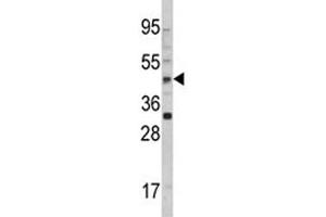 Western blot analysis of AADAC antibody and 293 lysate. (AADAC Antikörper  (AA 273-300))