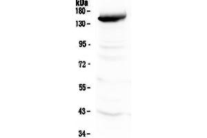 Western blot analysis of VEGF Receptor 3 using anti-VEGF Receptor 3 antibody . (FLT4 Antikörper  (AA 25-259))
