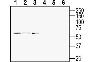 Western blot analysis of mouse  T-cell lymphoma cell line lysate (lanes 1 and 4), human Jurkat T-cell leukemia cell line lysate (lanes 2 and 5) and mouse  microglia cell line lysate (lanes 3 and 6):1-3. (GPR108 Antikörper  (Extracellular))