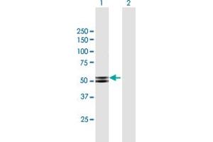 Western Blot analysis of PRKAR2B expression in transfected 293T cell line by PRKAR2B MaxPab polyclonal antibody. (PRKAR2B Antikörper  (AA 1-418))