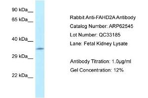 Western Blotting (WB) image for anti-Fumarylacetoacetate Hydrolase Domain Containing 2A (FAHD2A) (N-Term) antibody (ABIN2789175) (FAHD2A Antikörper  (N-Term))