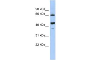 Western Blotting (WB) image for anti-Aldehyde Dehydrogenase 7 Family, Member A1 (ALDH7A1) antibody (ABIN2463934) (ALDH7A1 Antikörper)