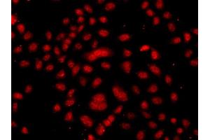 Immunofluorescence analysis of  cells using FBXW11 antibody (ABIN6133150, ABIN6140529, ABIN6140530 and ABIN6223739). (FBXW11 Antikörper  (AA 1-140))