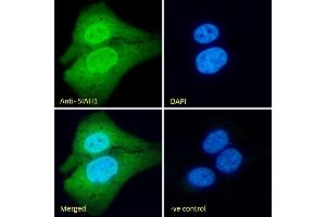 Immunofluorescence (IF) image for anti-E3 Ubiquitin-Protein Ligase SIAH1 (SIAH1) (N-Term) antibody (ABIN184675)