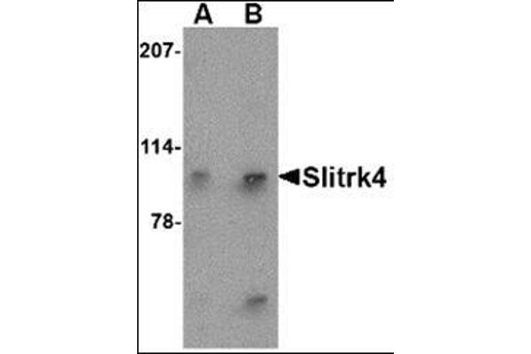 SLITRK4 antibody  (N-Term)