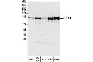 Western Blotting (WB) image for anti-Tripartite Motif Containing 24 (TRIM24) (AA 700-750) antibody (ABIN7454678) (TRIM24 Antikörper  (AA 700-750))