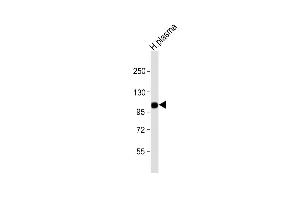 Anti-CFB Antibody (Center) at 1:1000 dilution + human plasma lysate Lysates/proteins at 20 μg per lane. (Complement Factor B Antikörper  (AA 469-494))