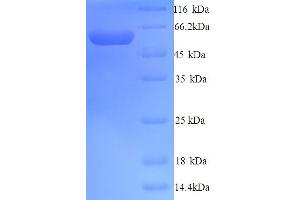 SDS-PAGE (SDS) image for Yes-Associated Protein 1 (YAP1) (AA 1-504), (full length) protein (His tag) (ABIN5713950) (YAP1 Protein (AA 1-504, full length) (His tag))
