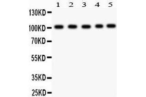 Anti- Band 3 Picoband antibody, Western blotting All lanes: Anti Band 3  at 0. (Band 3/AE1 Antikörper  (AA 28-365))