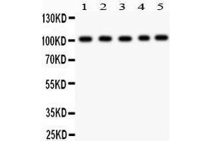 Anti- Band 3 Picoband antibody, Western blotting All lanes: Anti Band 3  at 0.