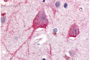 Anti-TRH Receptor antibody  ABIN1049427 IHC staining of human brain, neurons and glia.