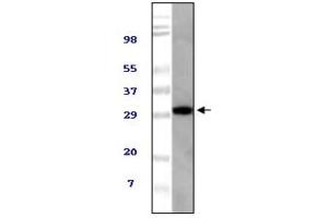 Western blot analysis using TUG antibody against NIH/3T3 cell lysate. (ASPSCR1 Antikörper)
