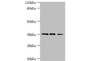 Western blot All lanes: FOSL2 antibody at 8 μg/mL Lane 1: MCF-7 whole cell lysate Lane 2: Jurkat whole cell lysate Lane 3: PC-3 whole cell lysate Secondary Goat polyclonal to rabbit IgG at 1/10000 dilution Predicted band size: 36, 35, 32 kDa Observed band size: 36 kDa (FOSL2 Antikörper  (AA 187-326))
