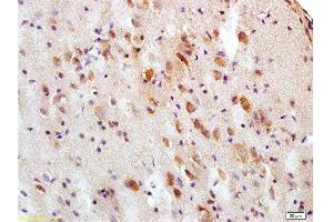 Formalin-fixed and paraffin embedded rat brain tissue labeled with Anti-Tau protein Polyclonal Antibody , Unconjugated at 1:200, followed by conjugation to the secondary antibody and DAB staining (tau Antikörper  (AA 683-758))