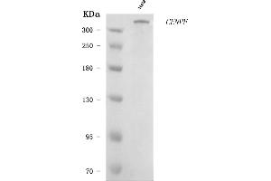 Western blot analysis of CENPF using anti-CENPF antibody (ABIN7599912).