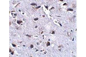 Immunohistochemistry (IHC) image for anti-Regulator of Calcineurin 2 (RCAN2) (Middle Region) antibody (ABIN1031056) (RCAN2 Antikörper  (Middle Region))