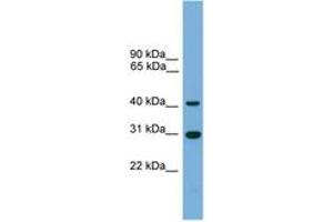 Image no. 1 for anti-Chromosome 1 Open Reading Frame 51 (C1orf51) (AA 143-192) antibody (ABIN6744999) (C1orf51 Antikörper  (AA 143-192))