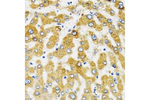 Immunohistochemistry of paraffin-embedded human liver using SLC27A2 antibody (ABIN1874822) at dilution of 1:100 (40x lens).
