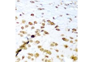 Immunohistochemistry of paraffin-embedded mouse brain using EL antibody (ABIN6134651, ABIN6140118, ABIN6140119 and ABIN6221704) at dilution of 1:200 (40x lens).
