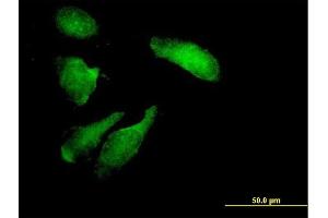Immunofluorescence of purified MaxPab antibody to STK11 on HeLa cell. (LKB1 Antikörper  (AA 1-433))