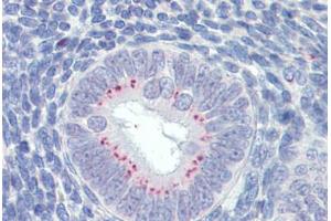Uterus, Human: Formalin-Fixed, Paraffin-Embedded (FFPE) (SFRP1 Antikörper  (AA 171-183))