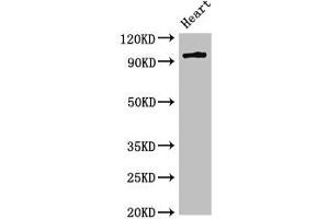 Western Blot Positive WB detected in: Rat heart tissue All lanes: PRKD3 antibody at 3 μg/mL Secondary Goat polyclonal to rabbit IgG at 1/50000 dilution Predicted band size: 101, 69 kDa Observed band size: 101 kDa (PRKD3 Antikörper  (AA 326-510))