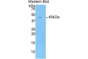 Western blot analysis of the recombinant protein. (CRH Antikörper  (AA 40-195))