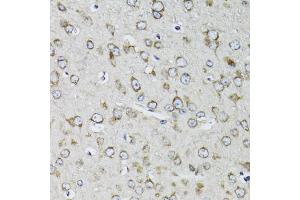 Immunohistochemistry of paraffin-embedded mouse brain using RPS10 antibody (ABIN1980247) at dilution of 1:100 (40x lens). (RPS10 Antikörper)