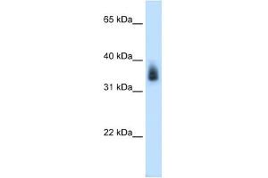MAGEA8 antibody used at 0. (MAGEA8 Antikörper  (N-Term))