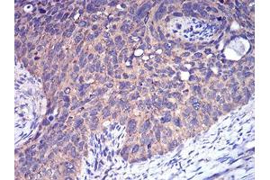 Immunohistochemistry (IHC) image for anti-Complement Factor H-Related 5 (CFHR5) (AA 344-569) antibody (ABIN5542639)
