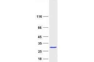 Validation with Western Blot (Transgelin Protein (TAGLN) (Transcript Variant 1) (Myc-DYKDDDDK Tag))