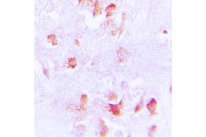 Immunohistochemical analysis of Creatine Kinase M staining in human brain formalin fixed paraffin embedded tissue section.