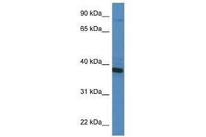 Western Blot showing CYB5R3 antibody used at a concentration of 1 ug/ml against HT1080 Cell Lysate (CYB5R3 Antikörper  (C-Term))