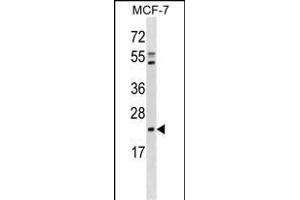 EBP Antibody (C-term) (ABIN1881278 and ABIN2838706) western blot analysis in MCF-7 cell line lysates (35 μg/lane). (EBP Antikörper  (C-Term))