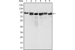Western blot analysis using MLH1 mouse mAb against Hela (1), MCF-7 (2) and A549 (3), Jurkat (4), 2R75 (5) and COS (6) cell lysate. (MLH1 Antikörper  (AA 381-483))